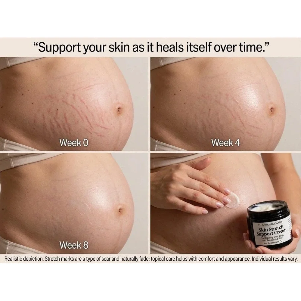PH Design Organics Skin Stretch Cream‎ 8oz Pregnancy Safe Stretch Mark Care